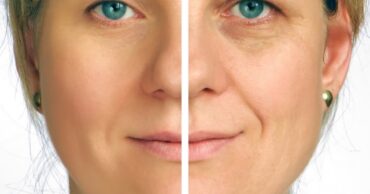 Resite se skupih krema i uklonite bore sa ovim jeftinim proizvodima