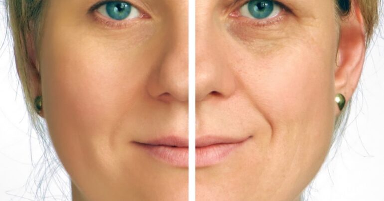 Resite se skupih krema i uklonite bore sa ovim jeftinim proizvodima