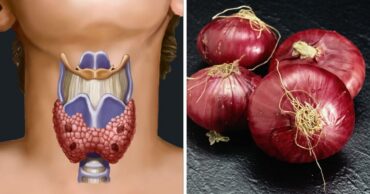 Izlečite štitnu žlezdu sa oblogama od luka