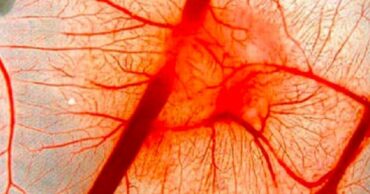 Ovaj narodni lek će vratiti elastičnost krvnih sudova za 3 dana