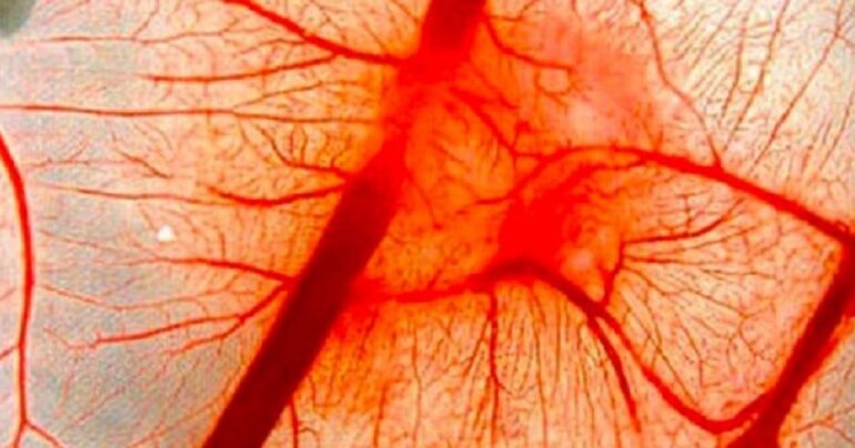 Ovaj narodni lek će vratiti elastičnost krvnih sudova za 3 dana