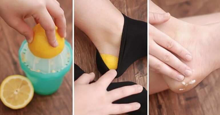 Stavila je koru limuna u čarapu… Kad sam saznala zašto je to učinila, bila sam oduševljena!