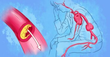 10 superhrana za efikasno čišćenje arterija i prevenciju srčanog udara!