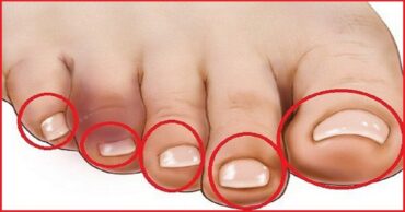 ZNAK DA VAM JE SRCE MOŽDA BOLESNO – PROVERITE JEDNOSTAVNOM METODOM