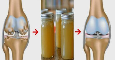 Lek protiv bolova u zglobovima za jačanje kostiju i popravku hrskavice