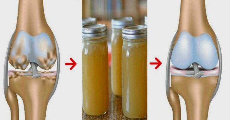 Lek protiv bolova u zglobovima za jačanje kostiju i popravku hrskavice