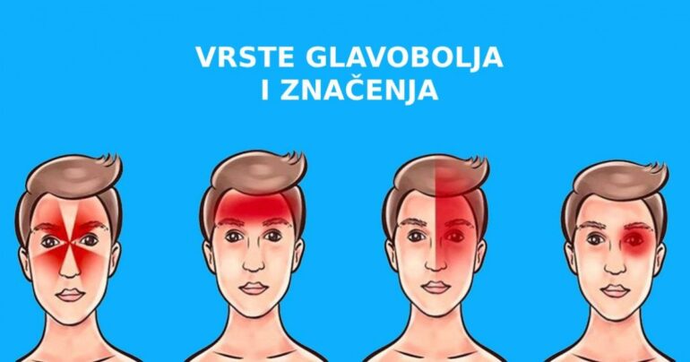 JAKO KORISNO: Koje vrste glavobolja postoje i šta one znače