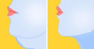 8 vežbi koje će vam pomoći da se rešite podbradka