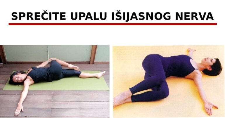 Sprečite upalu išijasnog nerva sa ovih 8 vežbi! 100% efikasne!