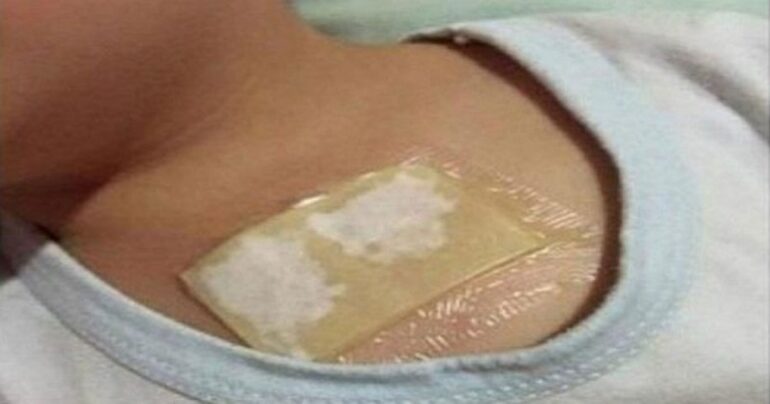 Odstranjuje jak kašalj, uklanja sekret iz pluća i bronhija za samo jednu noć: ovo je spas…