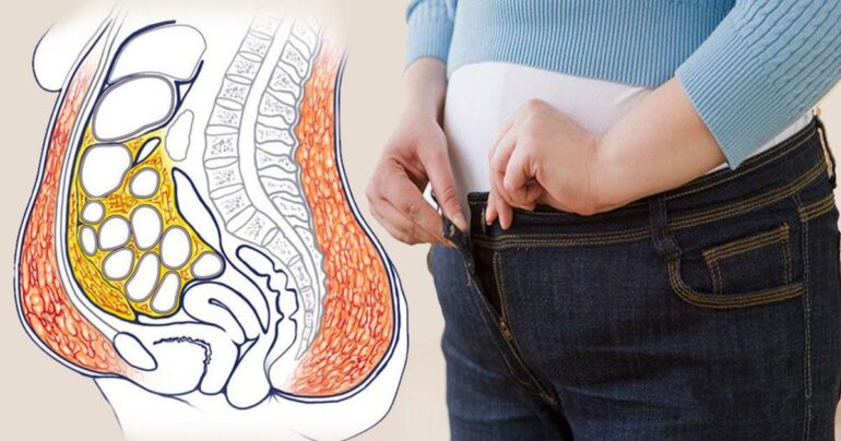 Za mesec dana je smršala sa 87 na 65 kg, uz minimalnu izmenu u ishrani! Ovo će vam pomoći da hitno smršate…