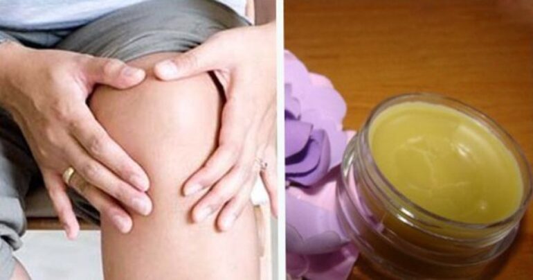 Čudotvorna mast koja će ublažiti bolove u zglobovima i izlečiti radikulitis, artritis…