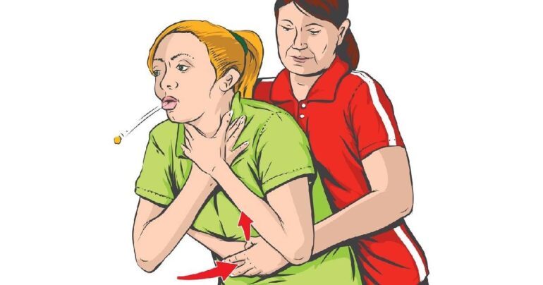 Tehnika koja nekome može spasiti život! Evo šta treba učiniti ako vam se nešto zaglavi u grlu