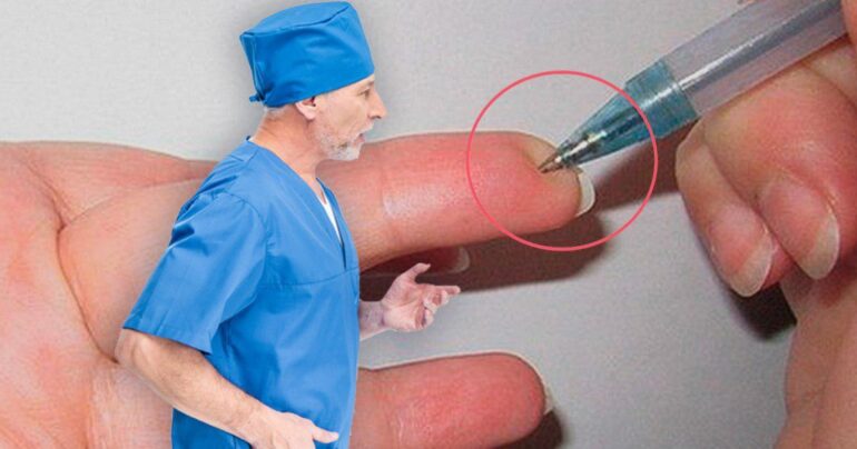 Pritiskom na ovu tačku možete u tren oka smanjiti pritisak! Naglo smanjuje pritisak, normalizuje mnoge stvari