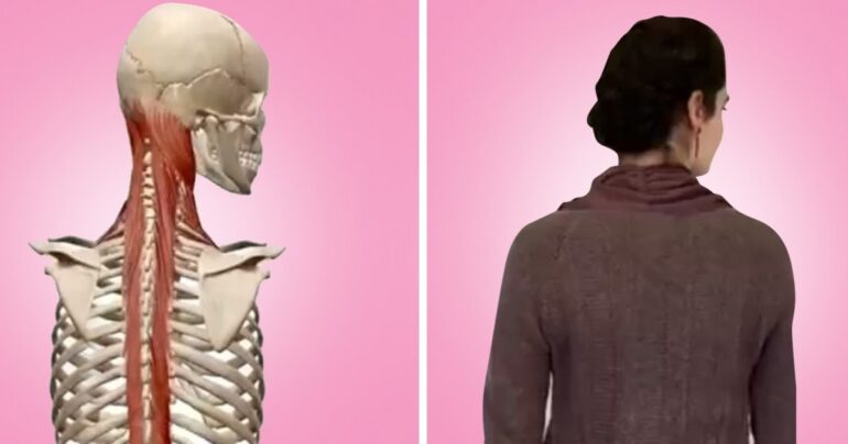 Radite ovih 5 vežbi svakodnevno i zaboravite na bolove u leđima