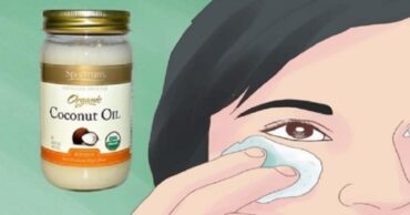 Sada izgledam 10 godina mlađe: sve zahvaljujući magičnom efektu kokosovog ulja…