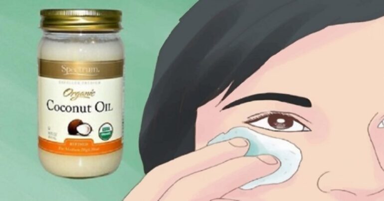 Sada izgledam 10 godina mlađe: sve zahvaljujući magičnom efektu kokosovog ulja…