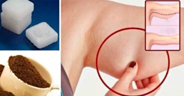 Naborani vrat, mlitave ruke i opušteni kukovi stvar su prošlosti! Ovaj lek će uznemiriti plastične hirurge