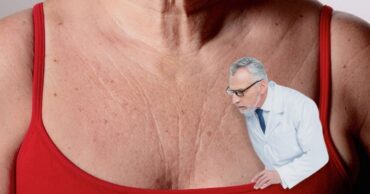 Bore na dekolteu i vratu – zategnite ih uspešno jednostavnim maskama koje ćete napraviti sami kod kuće