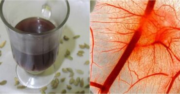 Recept za stabilan pritisak 120/80 i čiste krvne sudove