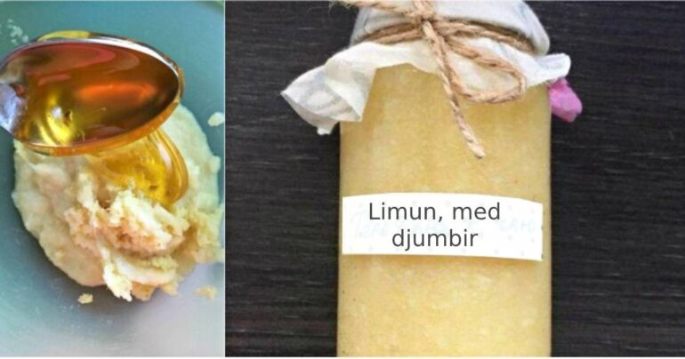 Zaboravite instant napitke protiv gripa! Limun, med i đumbir i grip je kao rukom odnešen