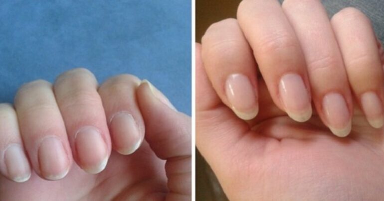 Kako da vaši nokti brzo rastu i nikada se ne slome: pomoći će vam jednostavan lek od 4 sastojka!
