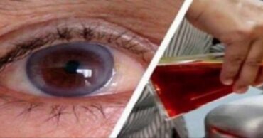 Vreme je da bacite naočare! Ova tehnika će poboljšati vid za 97%