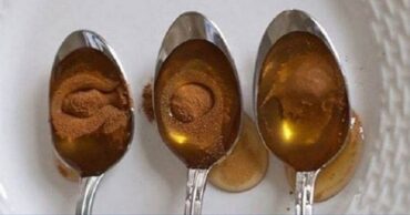 Ova žena svako jutro pojede kašiku meda i cimeta… Rezultati su zaista neverovatni!