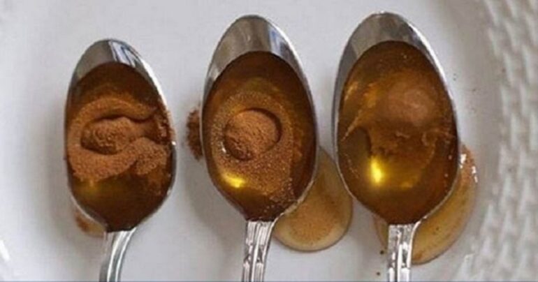 Ova žena svako jutro pojede kašiku meda i cimeta… Rezultati su zaista neverovatni!