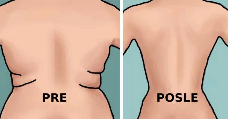 Uklonite masne naslage na kukovima i leđima pomoću 4 jednostavne vežbe: lepe obline za 3 nedelje!