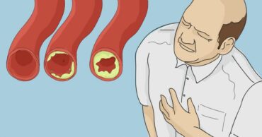 15 najboljih namirnica za čišćenje arterija i sprečavanje infarkta!