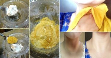 Učini to, i vrat će prestati da odaje tvoje godine! Osećam se 10 godina mlađe!