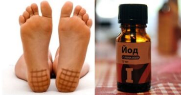 Jodna mreža: Evo šta ćete dobiti ako je nanesete na pete!