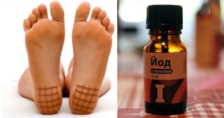 Jodna mreža: Evo šta ćete dobiti ako je nanesete na pete!