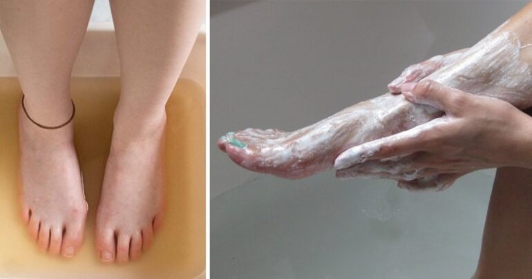 Potopite noge u toplu vodu sa sodom: Podmladite stopala i oslobodite se gljivica zauvek