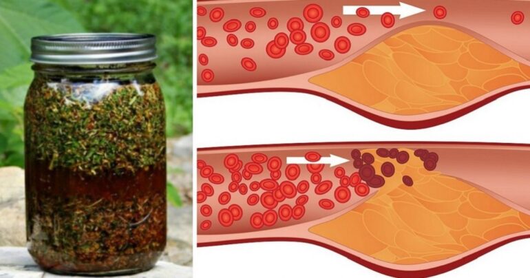 Mirođija, med i valerijana! Samo 1 kašika učiniće čudo za vaše krvne sudove