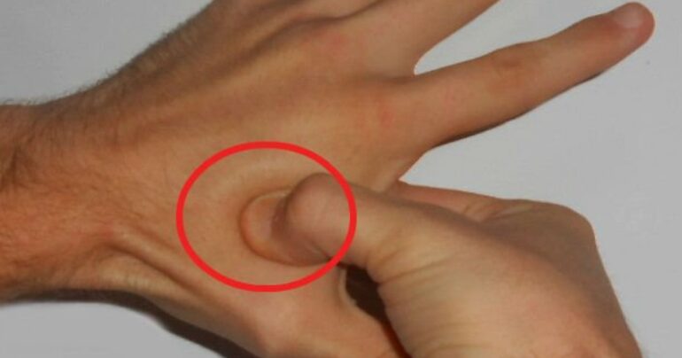 Pritisnite ovu tačku i oslobodite se glavobolje i stresa za 30 sekundi