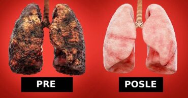 Kako KOMPLETNO očistiti pluća nakon pušenja