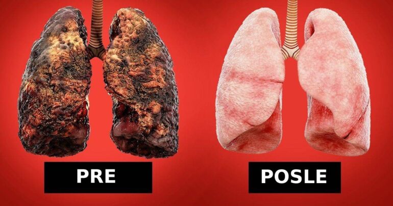 Kako KOMPLETNO očistiti pluća nakon pušenja