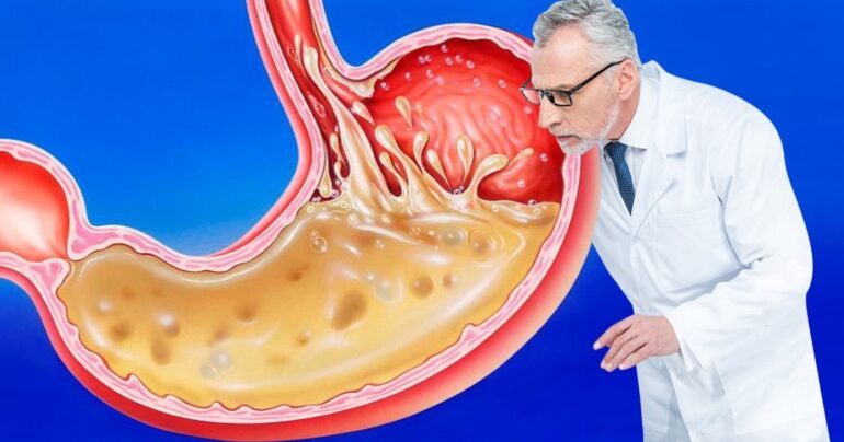 Učinite da vaš opušteni stomak ravnim i zategnutim!