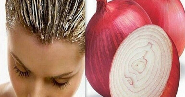 Najbolja maska protiv gubitka kose! Folikuli dlake stvarno ožive!