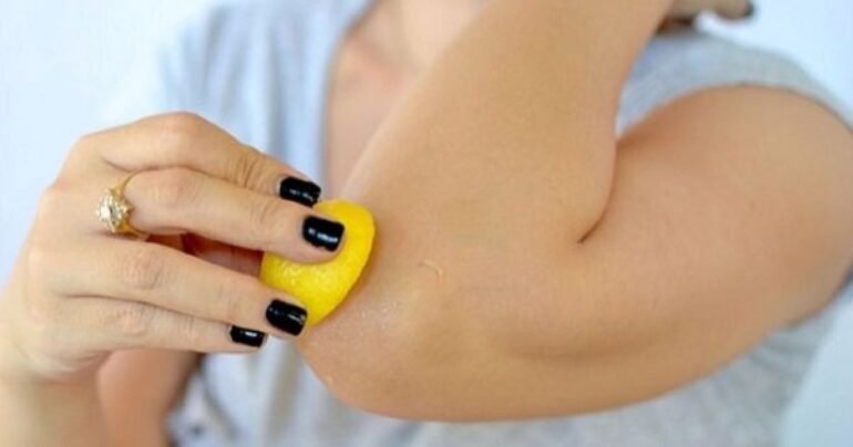 14 proizvoda za nežnu kožu laktova i kolena. Pravi kućni salon lepote!