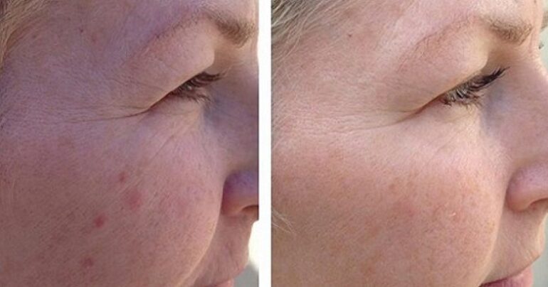Kako se brinuti za svoje lice da biste sačuvali njegovu mladost i postigli blistav sjaj