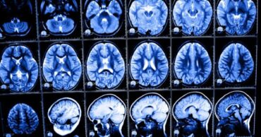 Sve više dece pati od poremećaja pažnje, gubitka pamćenja.. Ograničite im upotrebu telefona!