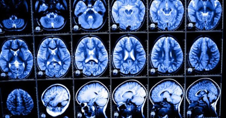 Sve više dece pati od poremećaja pažnje, gubitka pamćenja.. Ograničite im upotrebu telefona!