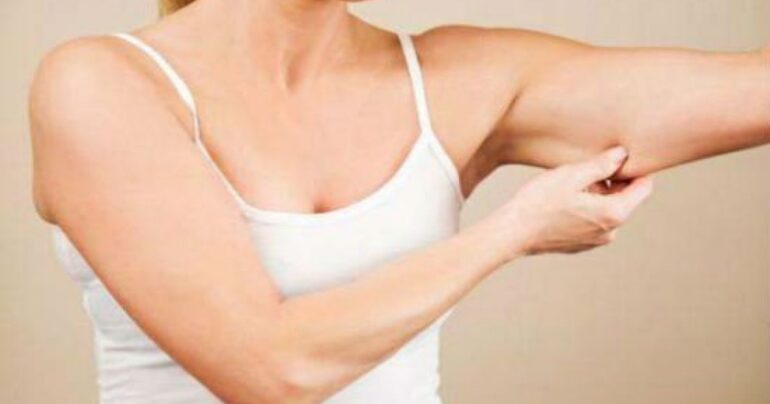 Rešite se „mlitavih ruku“. Jednom zasvagda!