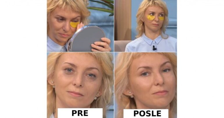 Vodič za izradu flastera za oči. Provereno uklanjaju kese ispod očiju