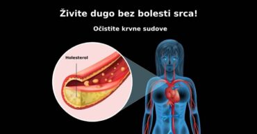 Živite dugo bez bolesti srca! Očistite krvne sudove!