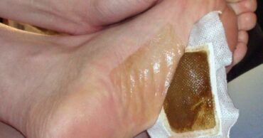 Narodnim lekom sa lukom kompletno očistite svoje telo od toksina