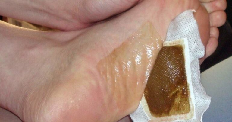 Narodnim lekom sa lukom kompletno očistite svoje telo od toksina